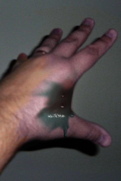 A hand with a nasty green wound.